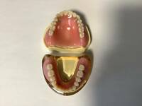 歯科　マグネット義歯(上下)模型