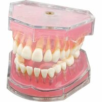 EUSTOMA 教学用 医学研究治療説明用 取り外し可能 歯茎が柔らかい 上下顎1 歯が抜く説明モデル 歯列模型 90
